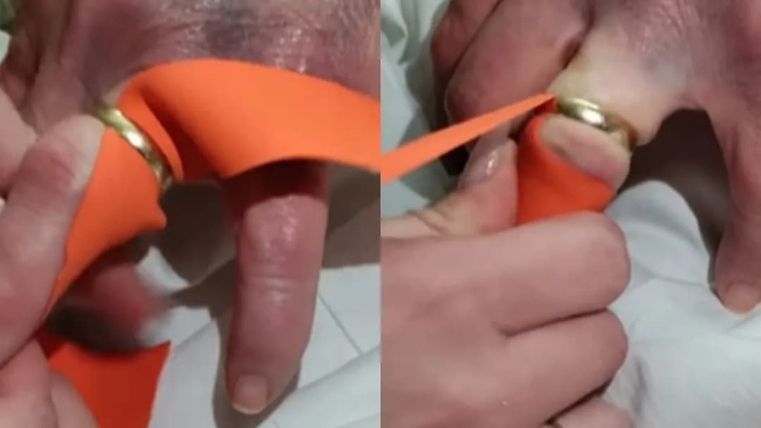 Jak ściągnąć obrączkę ze spuchniętego palca? Skuteczne metody i porady.