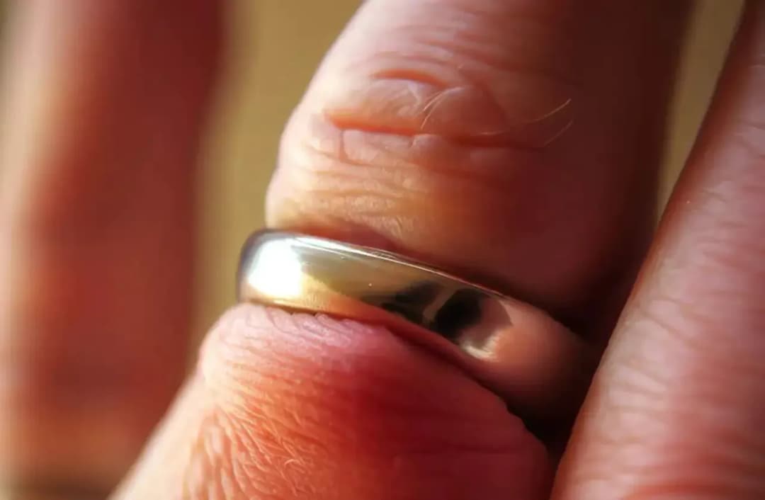 Ile kosztuje przecięcie obrączki na palcu i gdzie znaleźć najlepsze opcje?